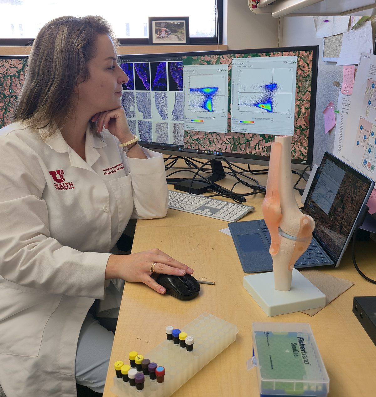 Dr. Harasymowicz analyzing synovial immune cell population from OA patients